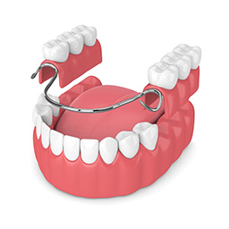 partial-dentures-right-for-you